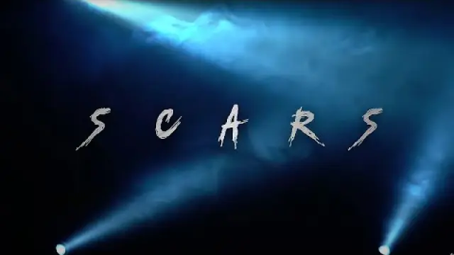 Scars